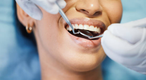 Best Dental Abscess Treatment in Grand Rapids, MI